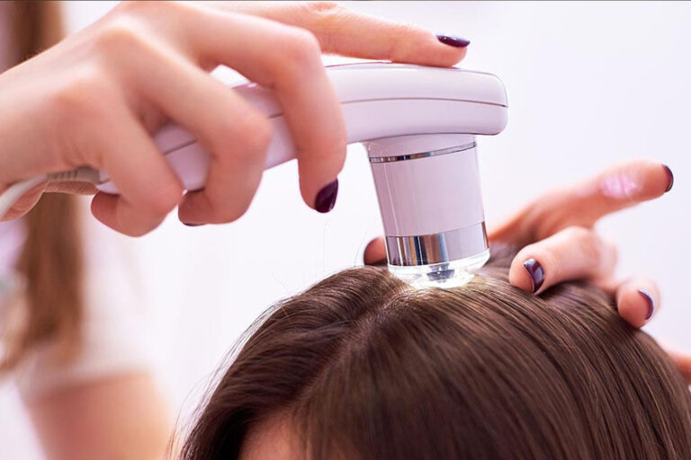 Ricostruzione dei Capelli a Sant'Antioco